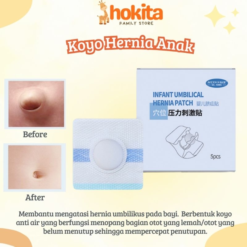 Koyo Herbal Hernia Bayi Anak / Infant Umbilical Hernia Patch / Koyo Herbal Bayi Anak / Stiker Hernia