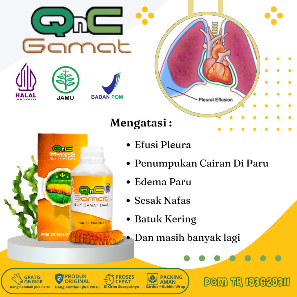 Obat Penumpukan Cairan Di Paru-Paru, Edema Paru, Sesak Nafas, Nyeri Dada, Batuk Kering, Demam, Obat 
