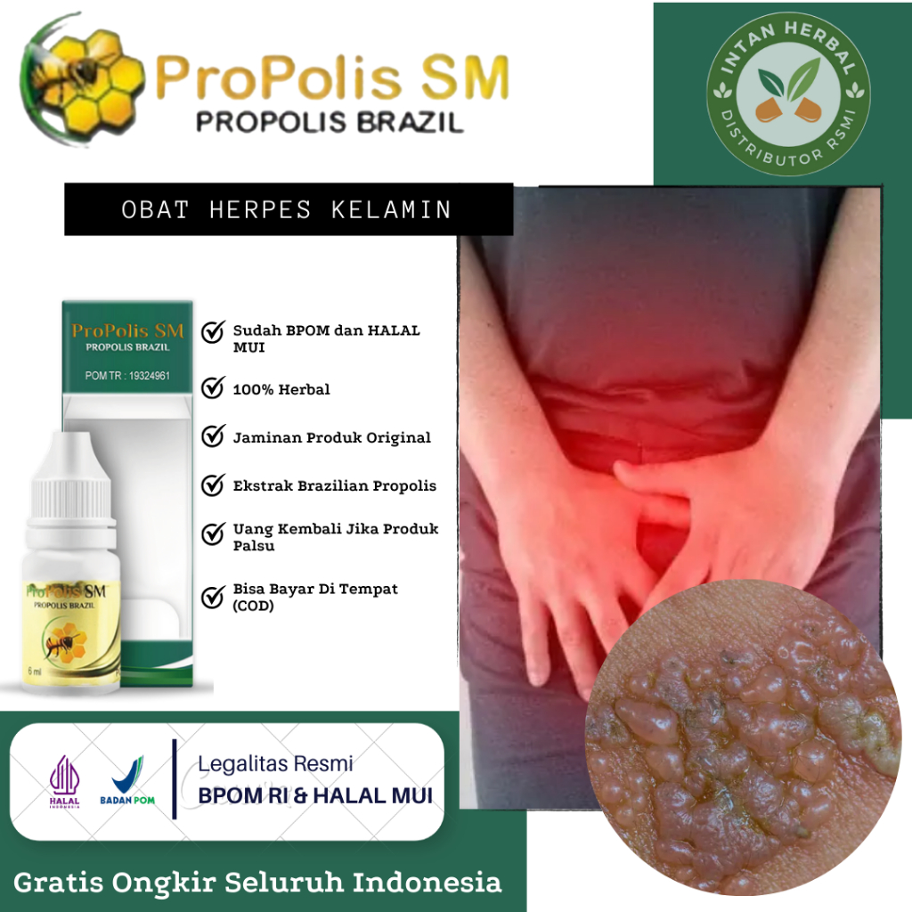Propolis SM - Obat Herpes Kelamin, Herpes Genital, Jamaur Kelamin, Herpes Zoster, Herpes Simplex, Ru