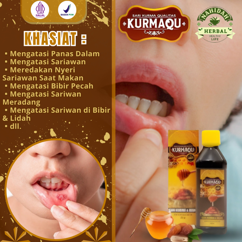 Sari Kurmaqu - Obat Radang Sariawa, Sariawan Parah, Obat Sariawan di Bibir, Obat Bibir Pecah - Pecah