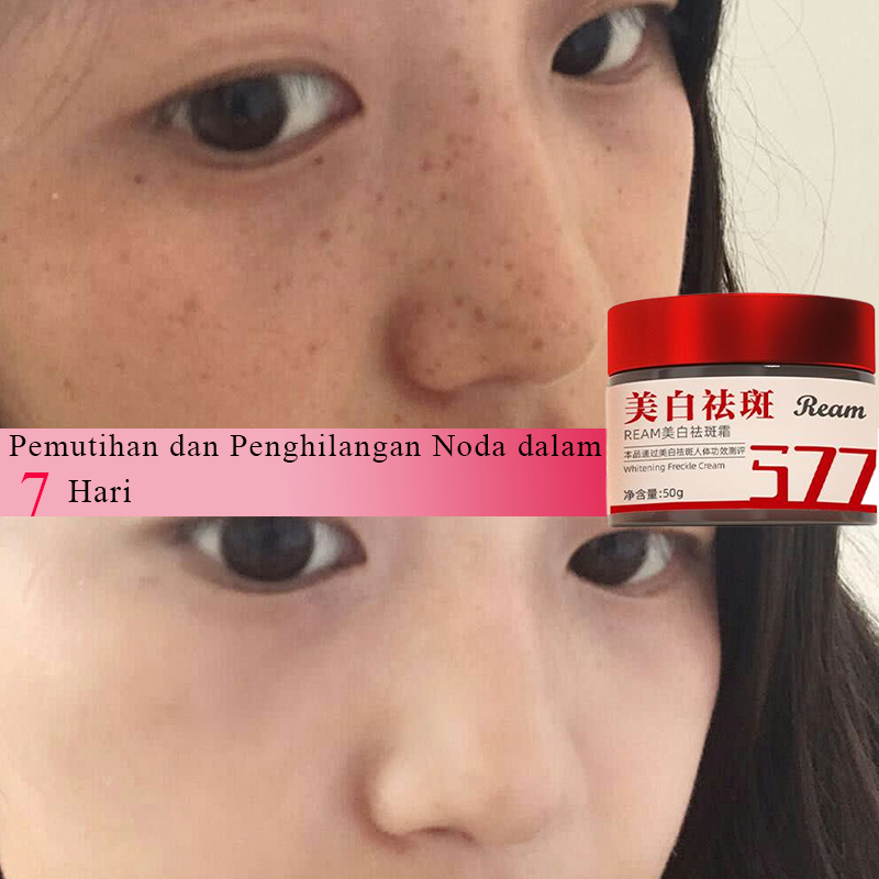 krim pemutih dan anti jerawat Krim wajah krim pemutih Krim penghilang flek hitam Krim pemutih wajah