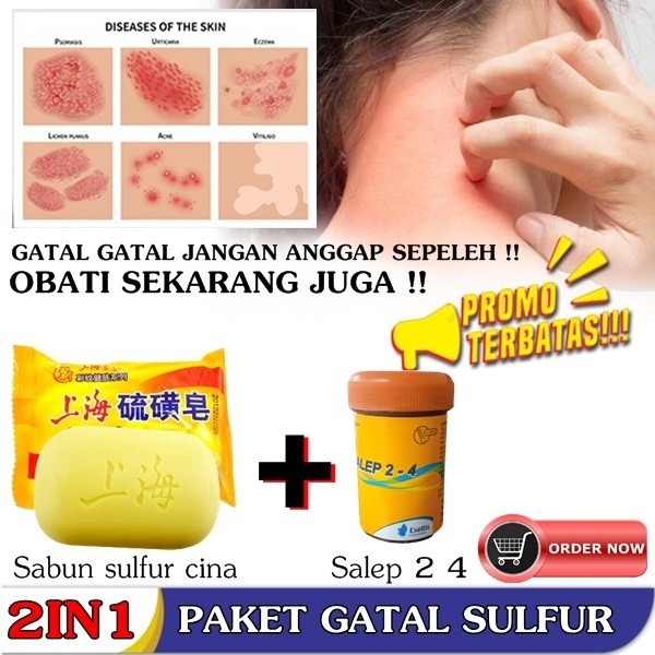 Paket gatal gatal sulfur sabun belerang china salep 2 4 zwafel ampuh100% Original Asli