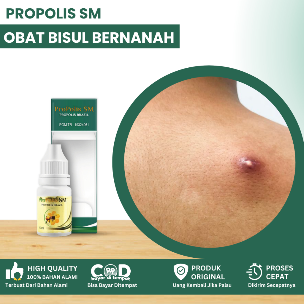 Obat Bisul Bernanah, Obat Bisul Anak Dan Dewasa, Obat Benjolan Bernanah, Obat Bisul Parah, Cenang Be