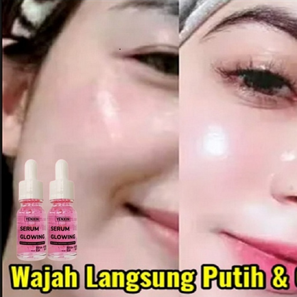 SERUM Penghilang Flek Hitam Membandel Di Wajah Paling Ampuh Permanen Bisa Untuk Pria Wanita Cream Pe