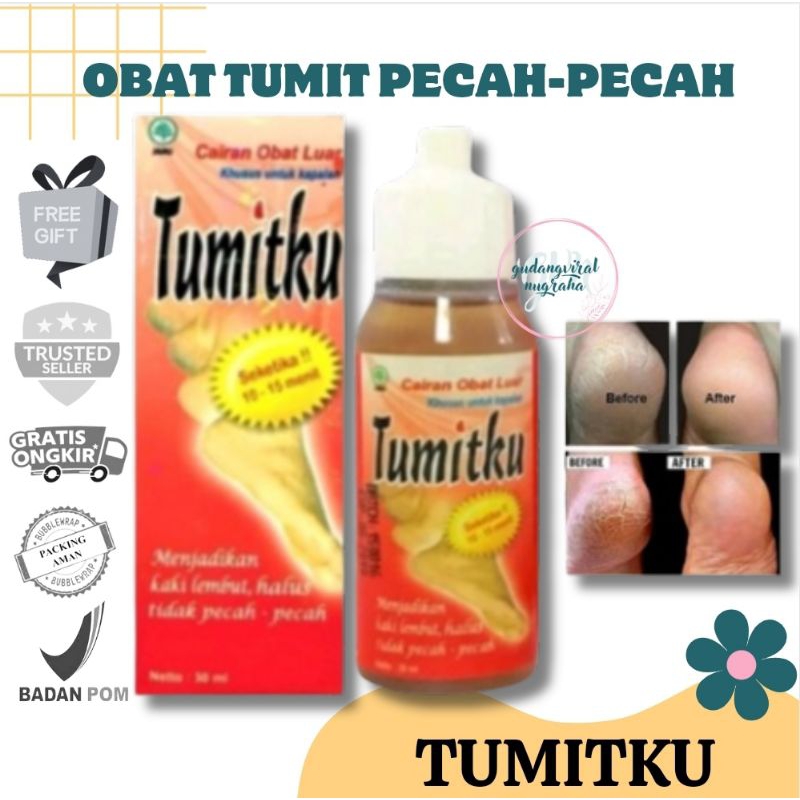 ☘️GVN☘️ TUMITKU OBAT KAKI KAPALAN DAN PECAH PECAH SOLUSI KAKI KERING KAPALAN KASAR MENGATASI KAKI PE