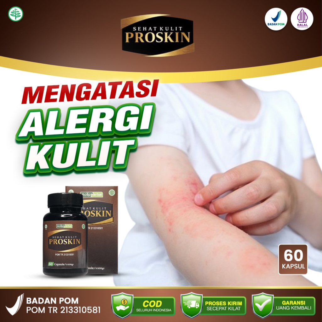 Suplemen Herbal Proskin 100% Original - Obat Alergi Kulit Ekzema Kurap Kudis Herpes Psoriasis
