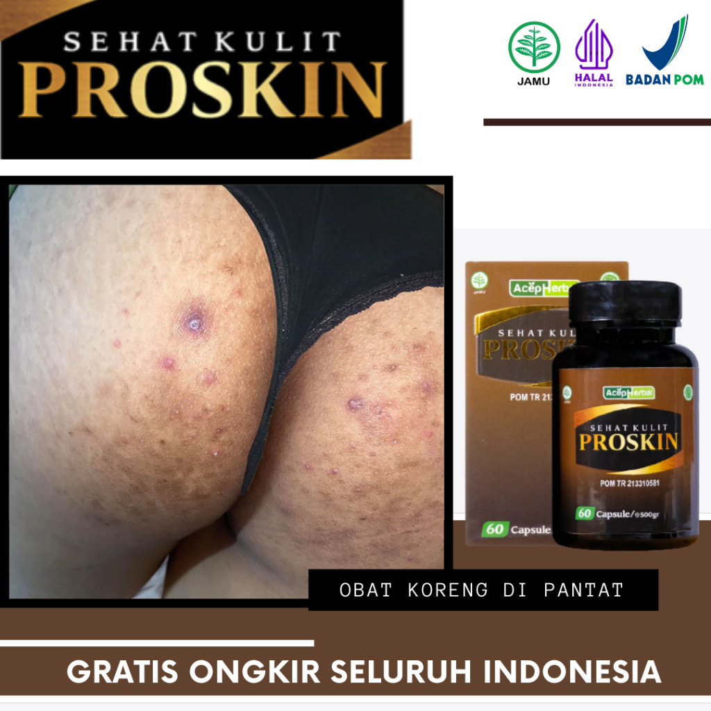 Obat Koreng di Pantat, Pantat Bruntusan, Bintik Hitam di Pantat, Pantat Burik, Jerawat di Bokong, Bo