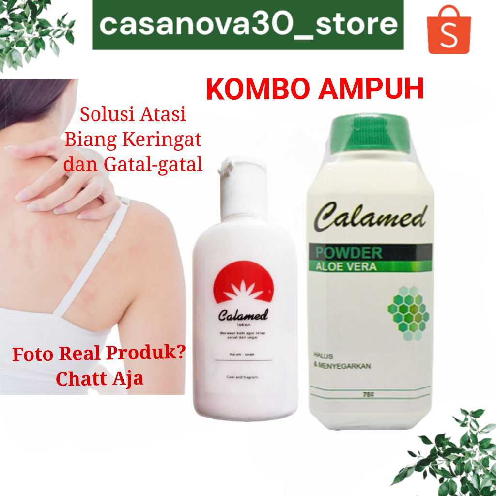 Calamed Lotion Calamed Powder Bedak biang keringat Lotion biang keringat Obat gatal gatal Ampuh