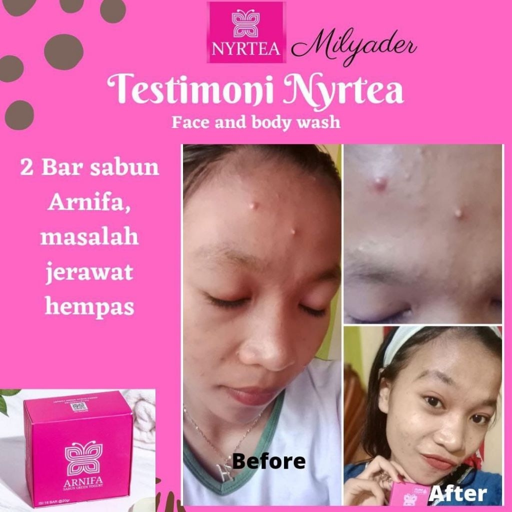 Sabun Glowing Nyr Tea Arnifa sekelas sabun multy beauty - sabun arnifa sabun multifungsi
