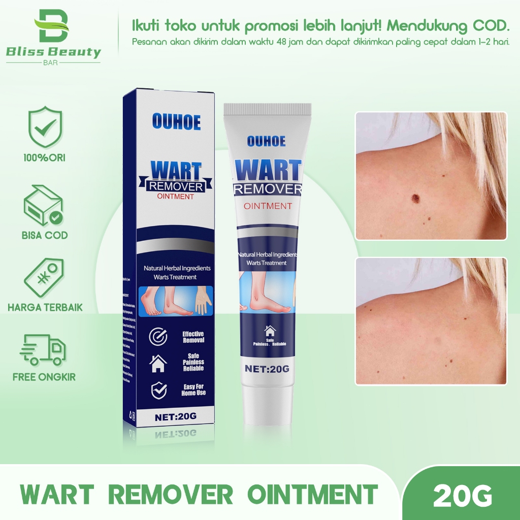 OUHOE Wart Remover Oitment 20g - Wart Remover Salep Obat Penghilang Tahi Lalat Dan Kutil Krim Herbal