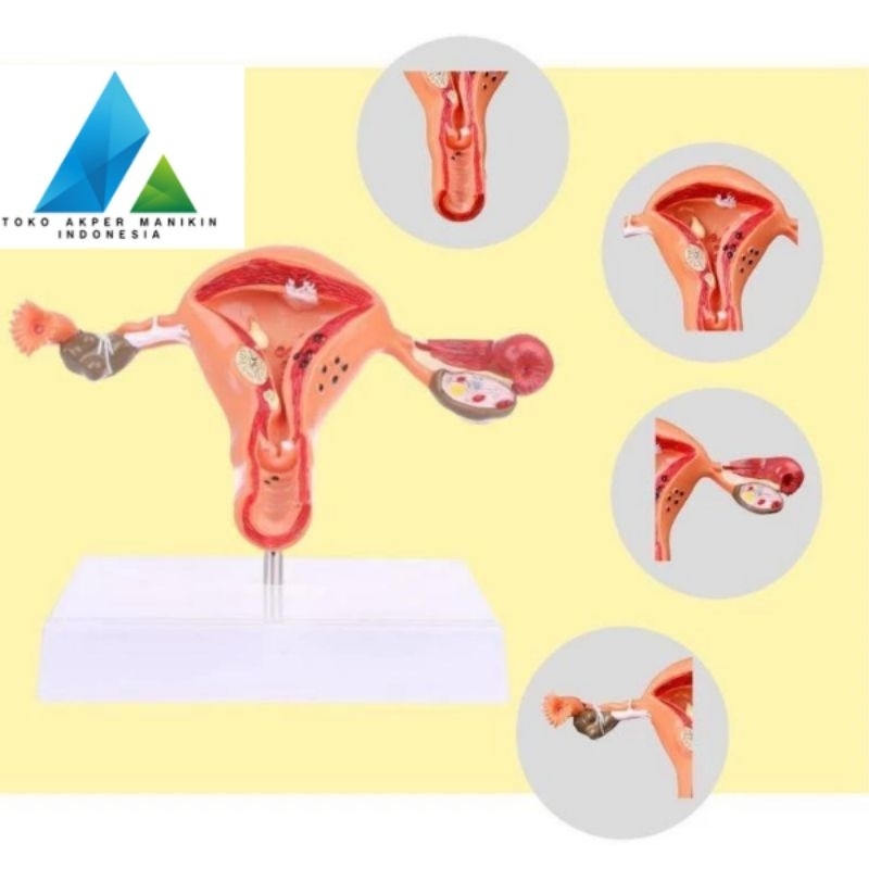 ALAT PERAGA UTERUS ANATOMICAL LOKAL | UTERUS OVARY ANATOMY MANIKIN