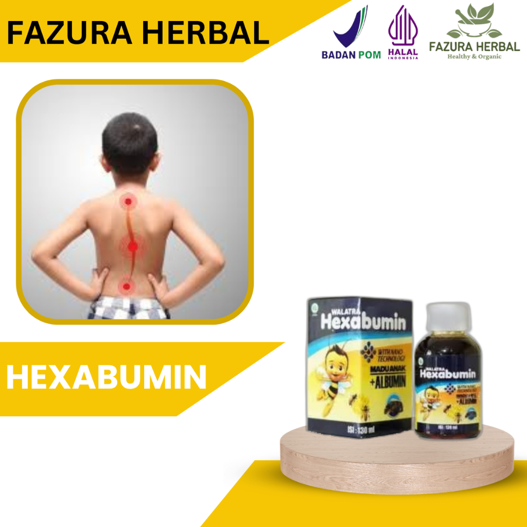 Hexabumin - Obat Skoliosis Anak, Obat Penguat Tulang Anak, Obat Pencegah Tulang Rapuh Anak