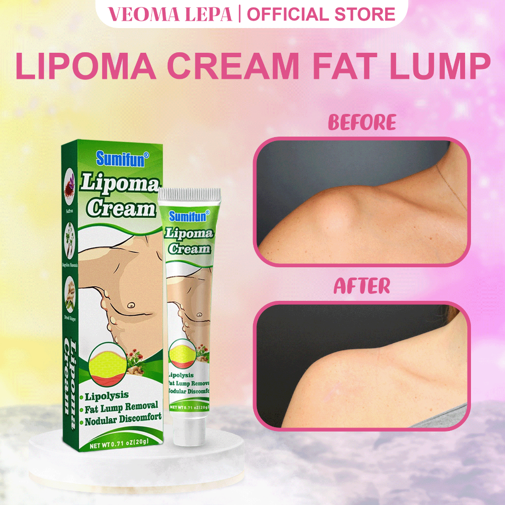 (COD) Sumifun Salep Obat Cream Lipoma Penghilang Lemak Benjolan Bengkak Kulit Herbal