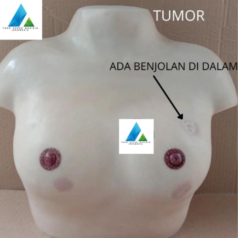 MANIKIN KANKER TUMOR PAYUDARA / ALAT PERAGA PHANTOM MANEKIN KANKER PAYUDARA