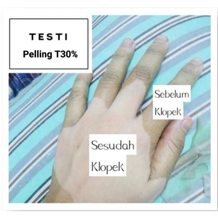 KODE E3Z3 PEELING 3 ANGKAT SEL KULIT MATI BADAN