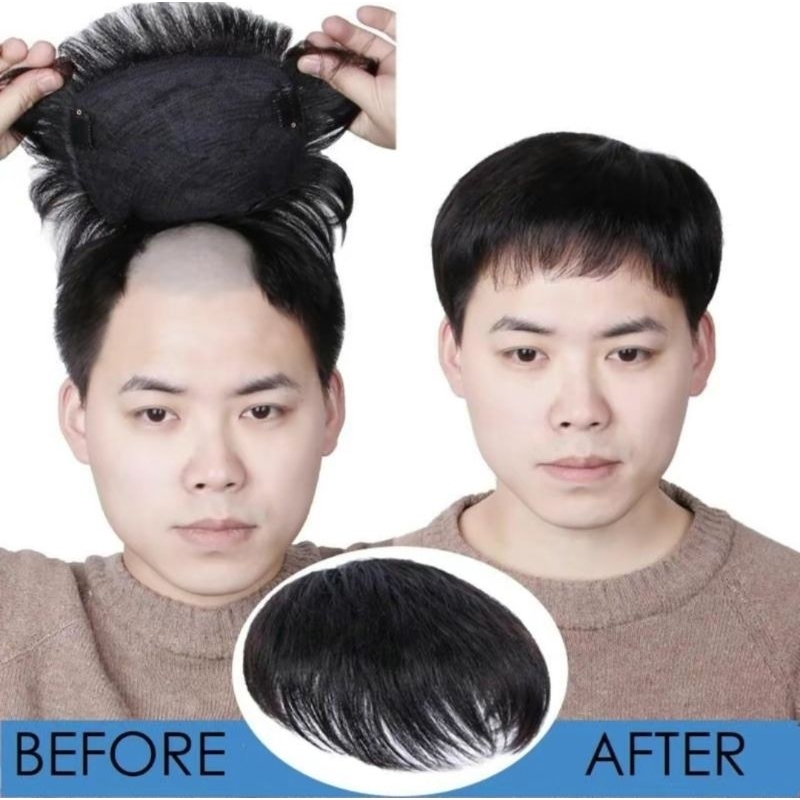 WIG TOUPEE PENDEK / RAMBUT PALSU PENUTUP BOTAK PRIA MODEL KOREA