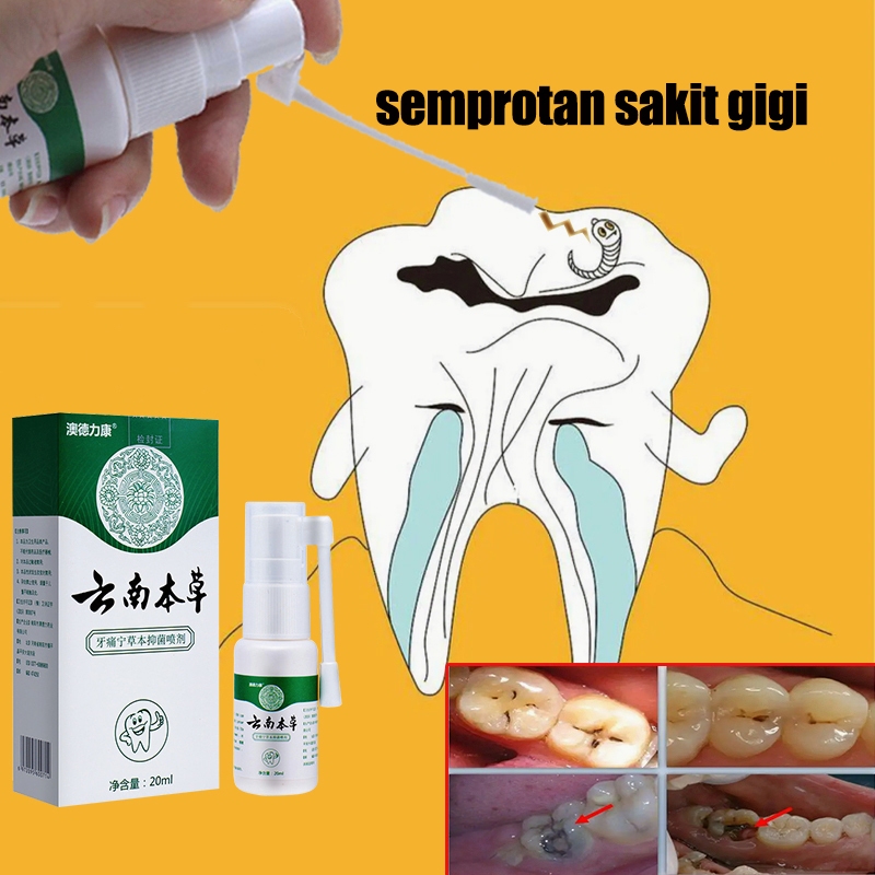Semprotan Pereda Sakit Gigi dan Bengkak Semprotan Mulut Pereda Sakit Gigi Berlubang Efektif untuk Gi