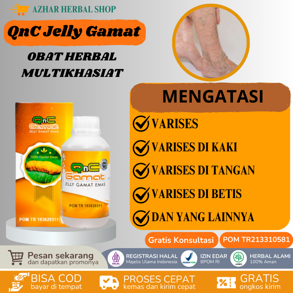QnC Jelly Gamat Obat Varises, Penghilang Varises, Varises di Kaki Tangan Betis Perut Wajah
