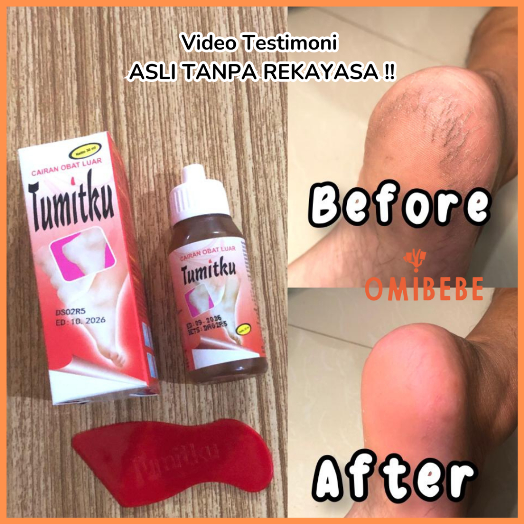 Tumitku Original BPOM 30ml Obat Kaki Kering Dan Pecah Mengatasi Kaki Kapalan Paling Ampuh