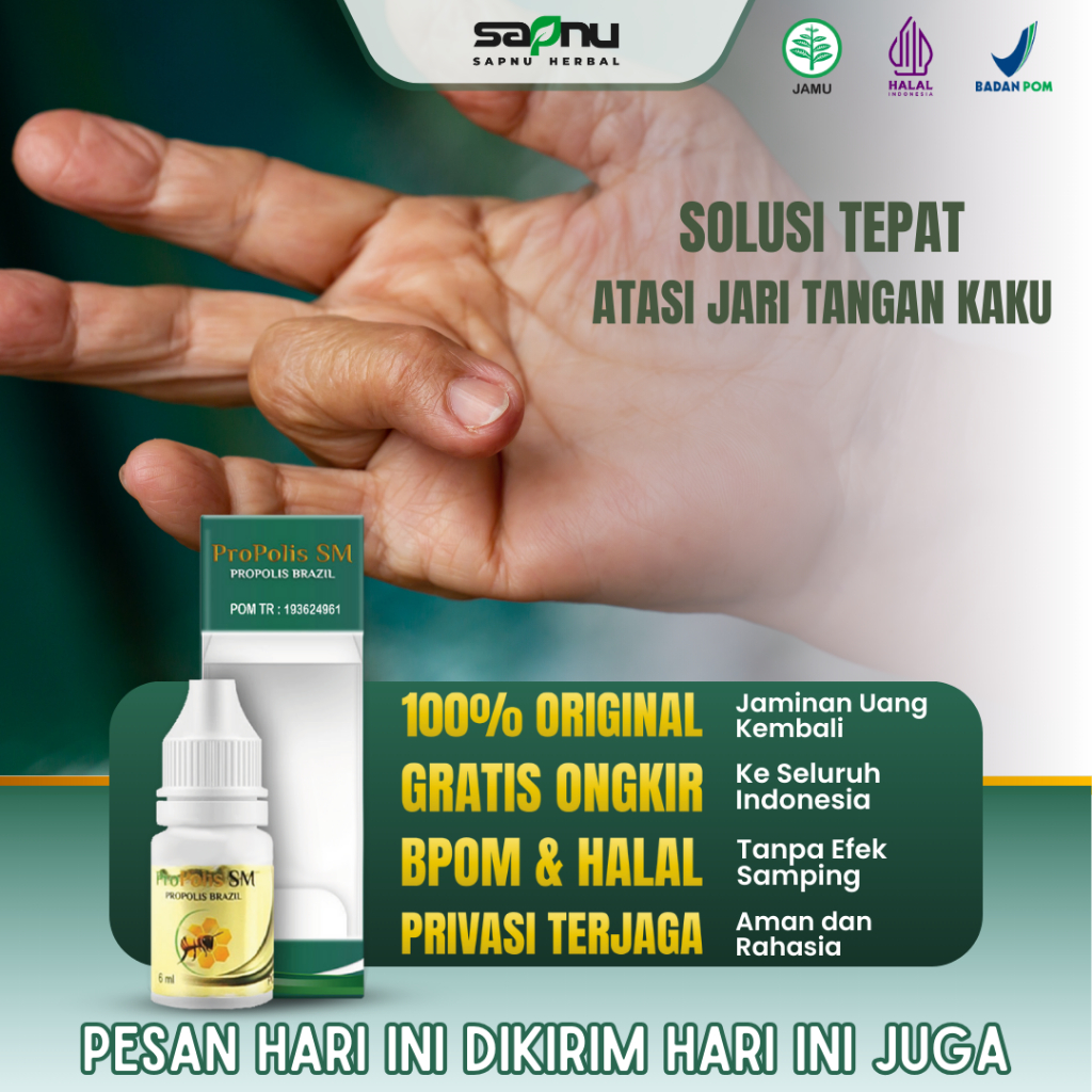 ProPolis SM - Obat Jari Tangan Kaku Dan Sakit, Trigger Finger, Jari Tangan Ngilu Dan Sakit,  Jari Su
