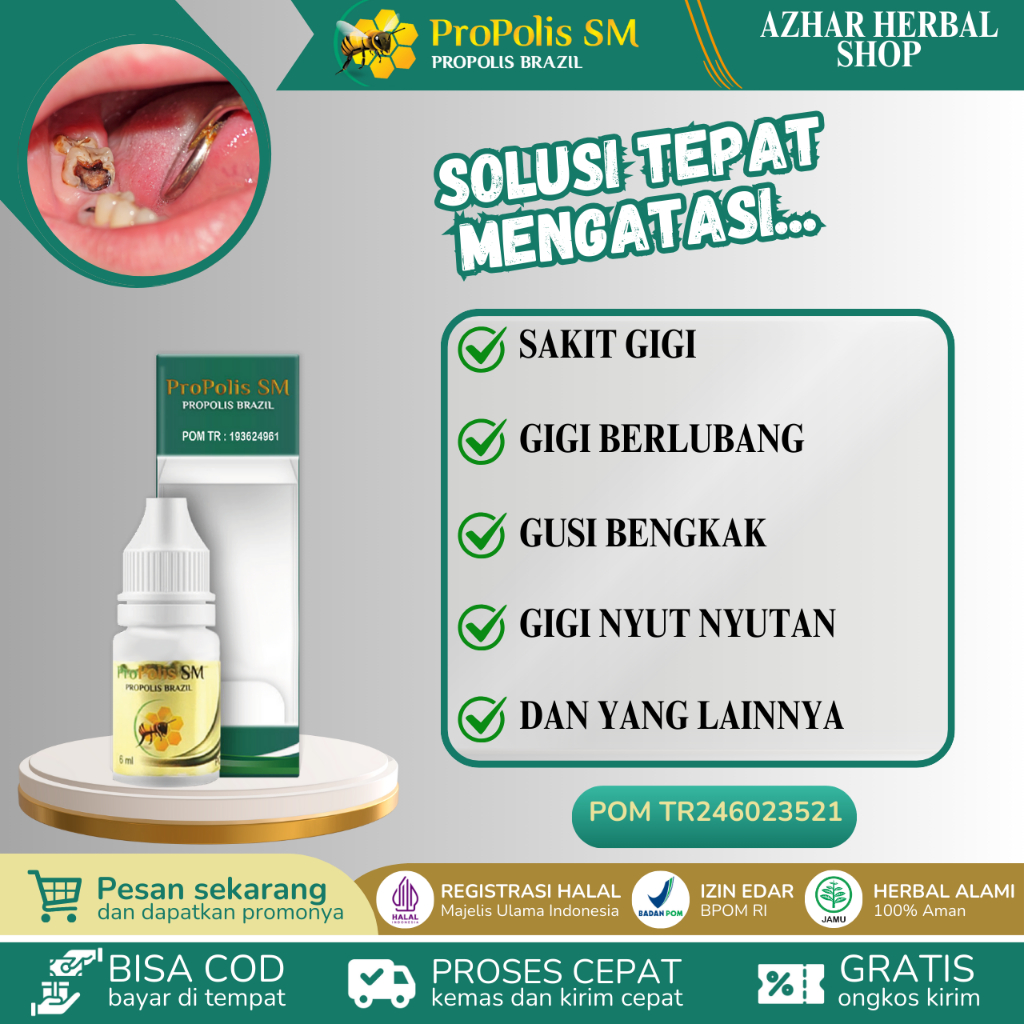 Propolis SM Obat Sakit Gigi Berlubang / Gigi Bolong, Obat Nyeri Gusi Bengkak, Obat Tetes Sakit Gigi