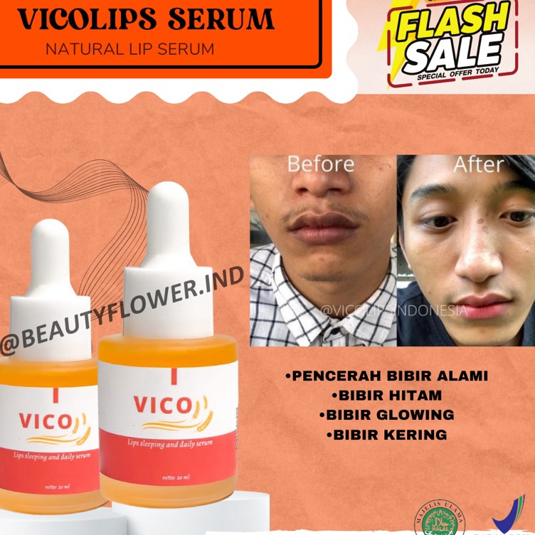 KODE D95F VICO LIPS SERUM BIBIR ORIGINAL  PENCERAH BIBIR  SERUM BIBIR  PEMERAH BIBIR  PEMERAH BIBIR 