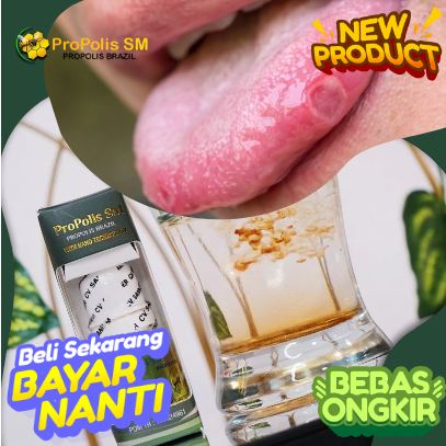 Obat Sariawan Lidah Perih Beruntus, lidah Pecah Pecah, Lidah Berjamur, Pembersih Lidah Putih, Penghi