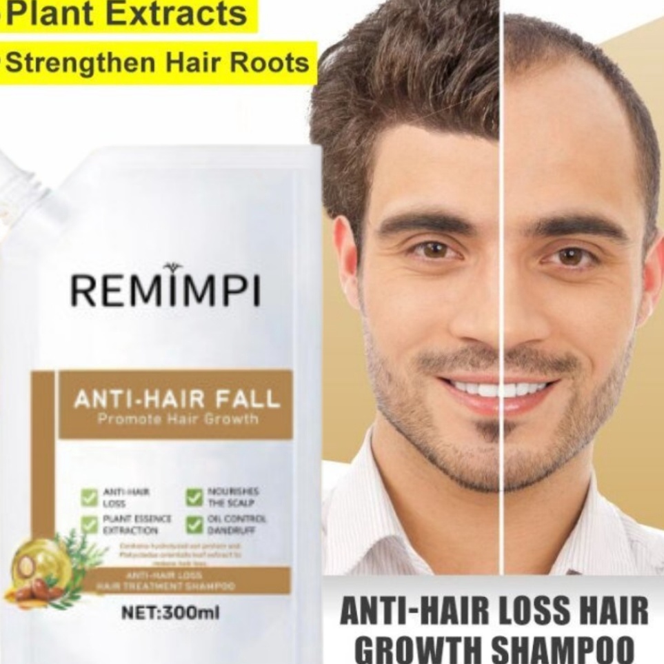 KODE B49N Remimpi Official  Shampoo Remimpi Penumbuh Rambut Botak dan Tipis