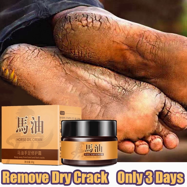 kaki obat kaki pecah dan kering krim obat kaki pecah pecah alat kaki pecah pecah cream kaki pecah pe