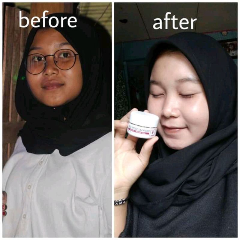 Deswari Skincare paket pemula/paket flek