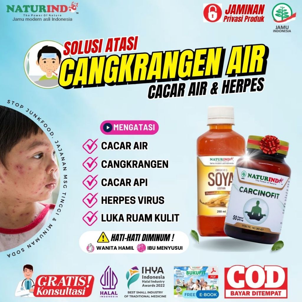 Obat Herbal Cacar Air Anak Dan Dewasa Obat Cangkrangen Berair Obat Cacar Api Herpes Paling Ampuh