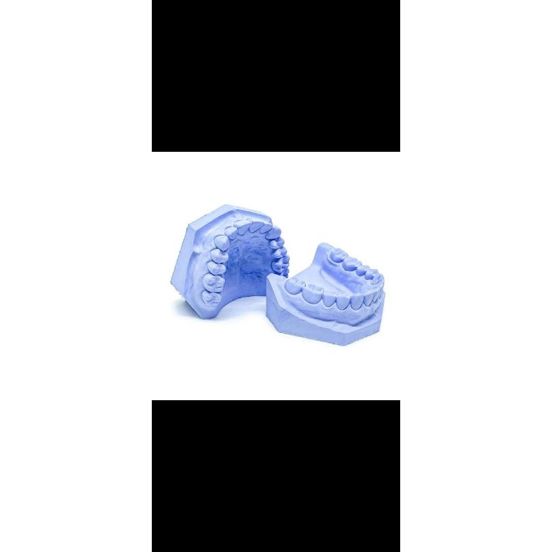 Model Gigi Gips Biru