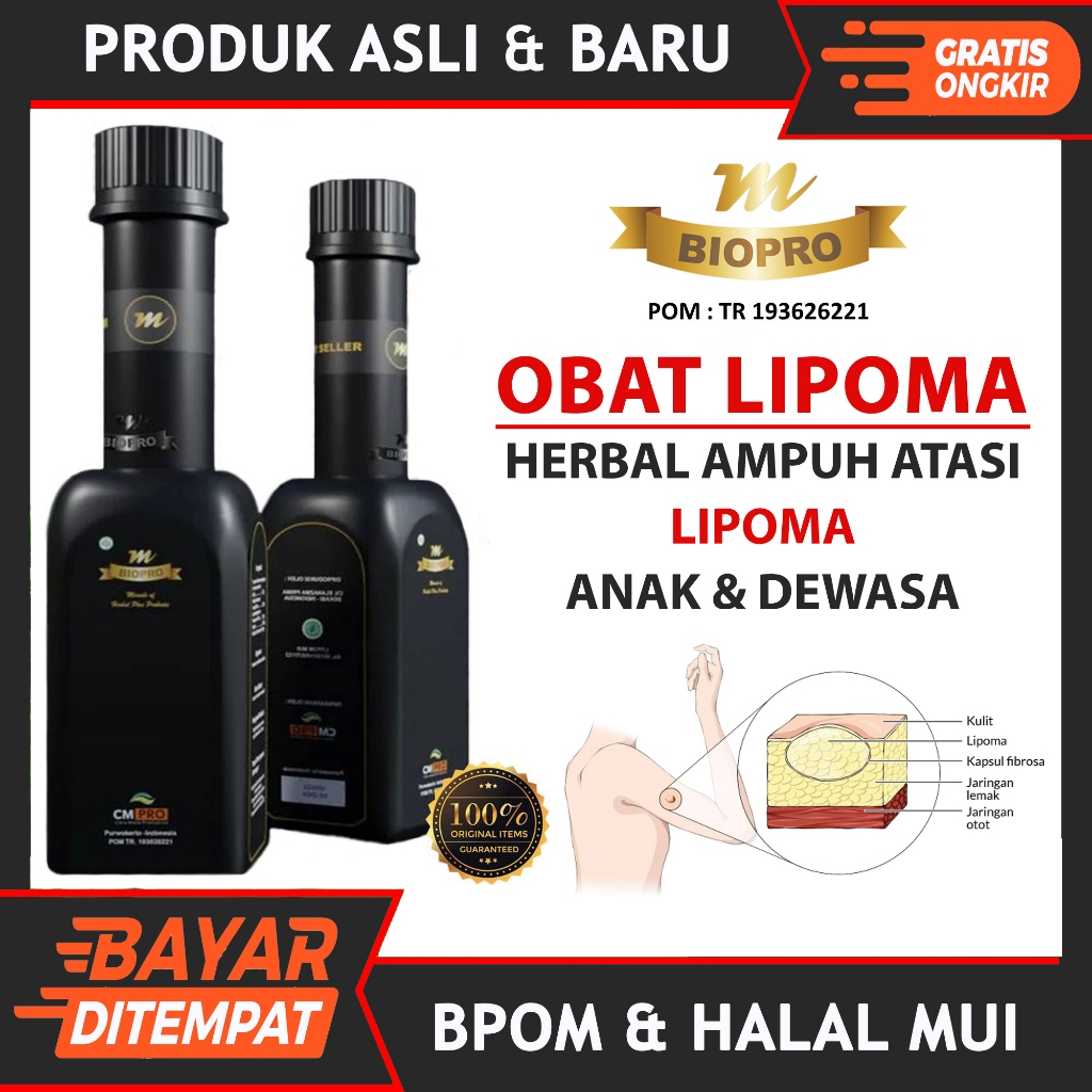 Obat Lipoma Benjolan Pada Anak & Dewasa Paling Ampuh Tanpa Operasi Mbiopro Original Herbal Bpom