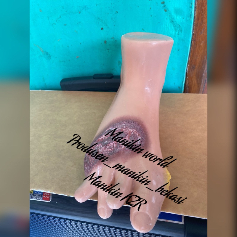 KAKI LUKA DIABETES / MANIKIN KAKI LUKA / MANIKIN KAKI LUKA DIABETES / MANEKIN KAKI LUKA BISA CUSTOM 