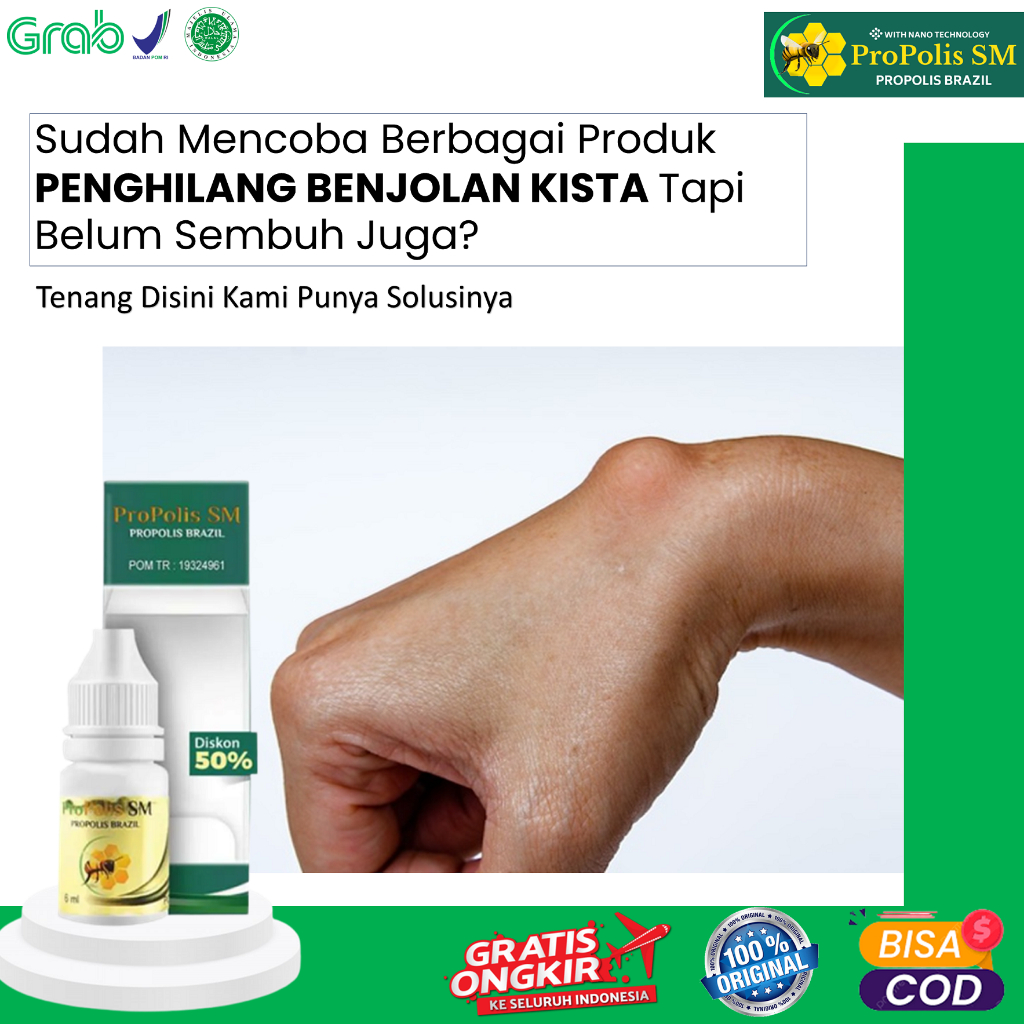 Obat Herbal Oles Benjolan Kista Ganglion Benjolan Di Tangan Di Kaki Di Selangkangan Propolis SM Braz