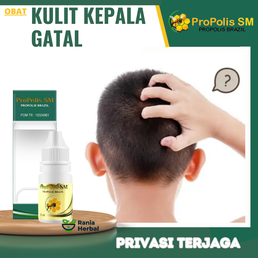 Obat Gatal Kepala, Obat Kulit Kepala Berjamur, Obat Gatal Kulit Kepala, Obat Ketombe Berkerak, Obat 