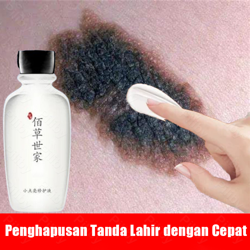 obat penghilang tanda lahir penghilang tanda lahir coklat coklat,hitam,merah di wajah,aman dan sanga