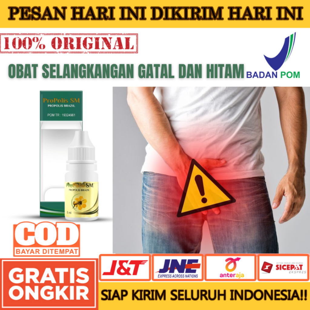 Obat Selangkangan Gatal Hitam Pria Dan Wanita, Gatal Selangkangan Eksim dan Jamur,Propolis SM- Medan