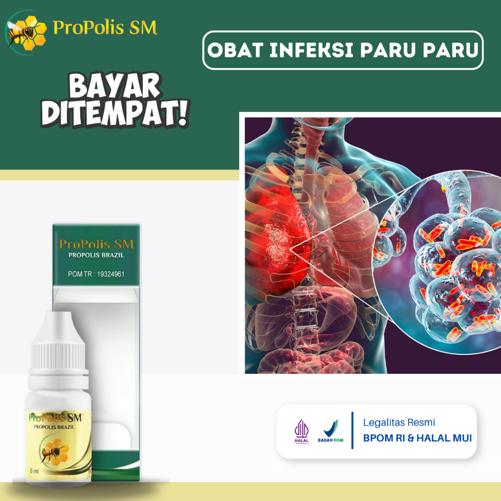 Obat Infeksi Paru Paru, Obat Flek Paru Paru, Obat Radang Paru, Obat Infeksi Paru Paru, Obat Pembersi