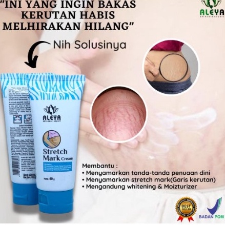 Cream Penghilang Bekas Luka Keloid Obat Strechmark Obat Penghilang Selulit Bpom Lhosiya Ampuh y CR9