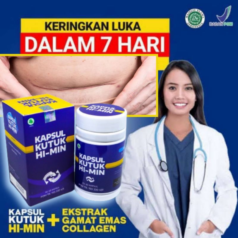 Kapsul Kutuk Ikan Gabus Pasca Operasi Albumin Ekstrak Obat Luka Bakar Hi Min 60 Pil Original