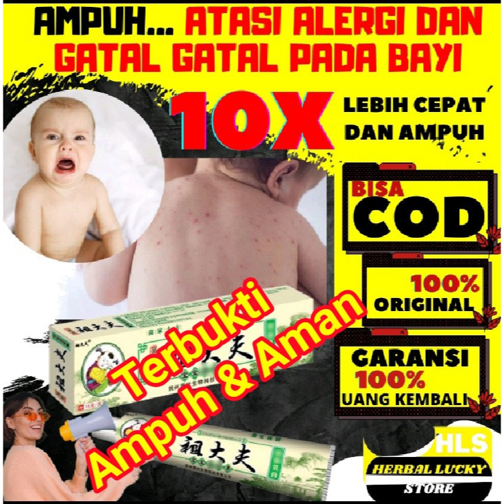 Obat Kulit Salep Gatal Cream ZUDAIFU CHY GAO Untuk Bayi Balita 0-7 Tahun Asli Original Untuk Psorias