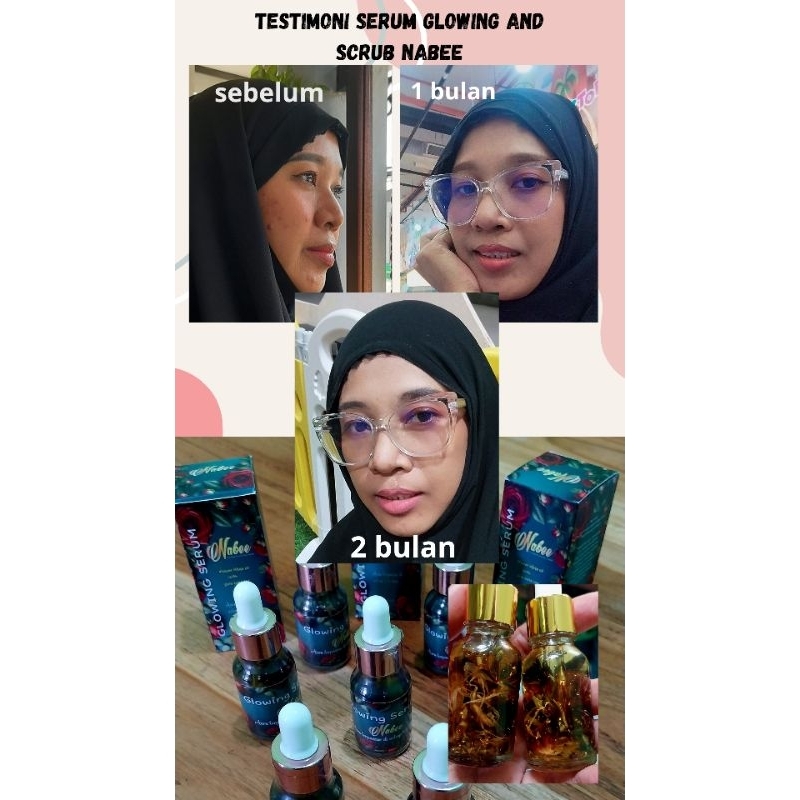 SERUM GLOWING NABEE ( SERUM INFUS FLOWER OIL DENGAN WANGI PARFUM SUNNAH KASTURI NABEE) UNTUK FLEK HI