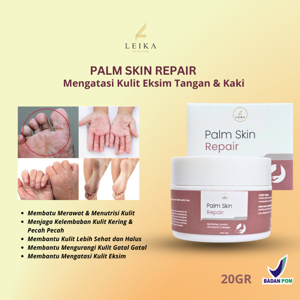 Penghalus kaki kasar dan pecah Pelembut tangan kasar kering kulit kering tangan dan kaki salep gatal