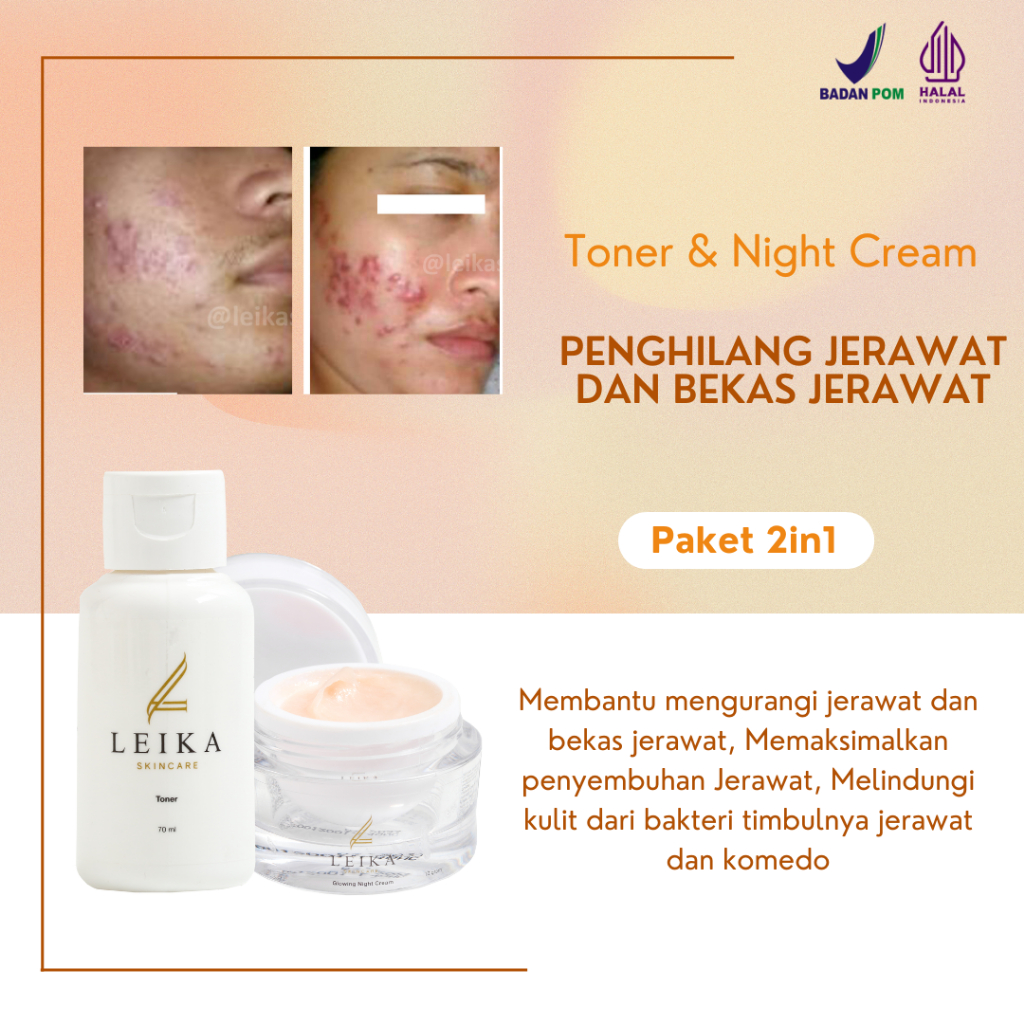 PAKET 2in1 [TONER & NIGHT CREAM] Penghilang Jerawat Dan Bekasnya Penghilang Jerawat Dan Bruntusan Pe