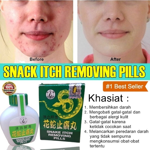 Obat Cina Snake Itch Removing Pills Obat gatal cap ular