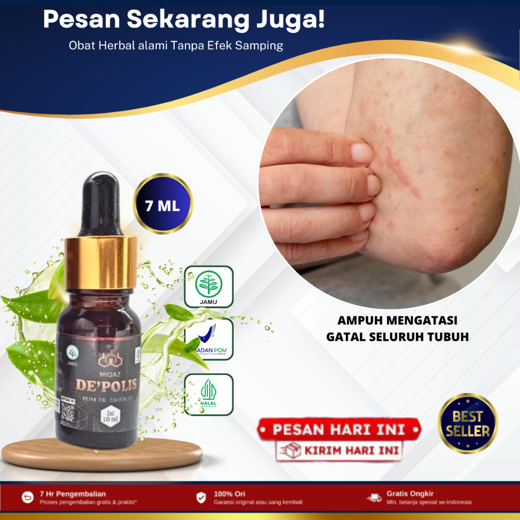 Obat Biduran Gatal Gatal Biduran Gatal Alergi Dingin Gatal Biduran Kaligata Biduran Menahun Biduran 