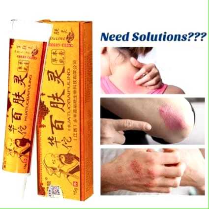 Salep Baifuling Original untuk Psoriasis, Eksim, Jamur, Kurap, dan Alergi Kulit - Cream Cina untuk M
