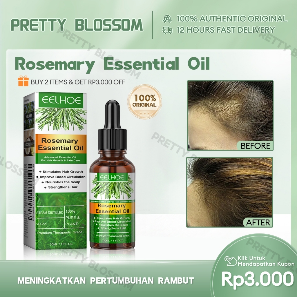 EELHOE Rosemary Hair Oil 30ml Serum Penumbuh Rambut Botak Perawatan Rambut Rambut Serum Penumbuh