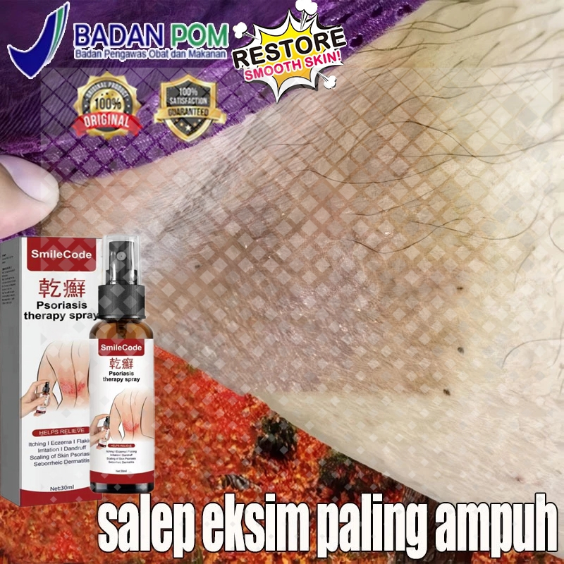 【HALAL & BPOM】Semprot psoriasis30ML salep gatal selangkangan salep eksim kering paling ampuh paling 